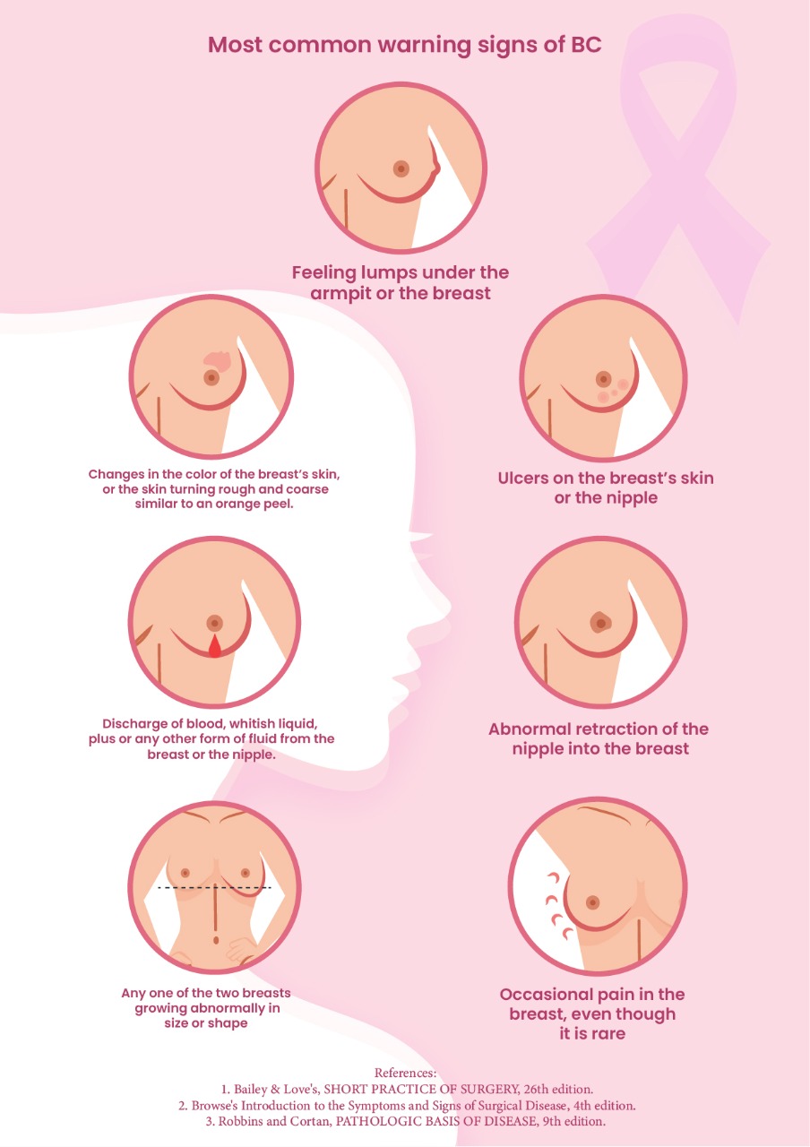 Most Common Warning Sign of Breast Cancer